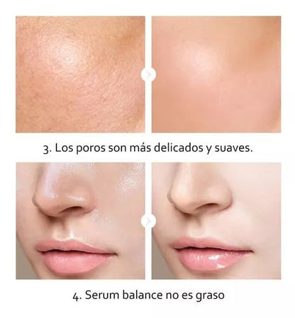 COMBO CAJA HILOS + SERUM GOLD 24K